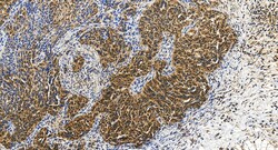 SETX Rabbit Polyclonal Antibody, Proteintech:Antibodies:Primary Antibodies