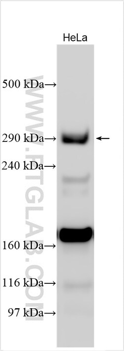 SETX Rabbit Polyclonal Antibody, Proteintech:Antibodies:Primary Antibodies