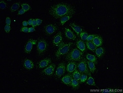 SFXN1 Mouse Monoclonal Antibody, Proteintech Unconjugated; 20 &mu;L:Antibodies,