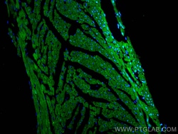 SGCZ Rabbit Polyclonal Antibody, Proteintech Unconjugated; 150 &mu;L:Antibodies,
