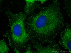SH3BP1 Mouse Monoclonal Antibody, Proteintech:Antibodies:Primary Antibodies