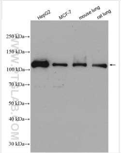 SH3BP4 Rabbit Polyclonal Antibody, Proteintech:Antibodies:Primary Antibodies