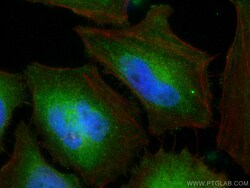 SH3GLB2 Mouse Monoclonal Antibody, Proteintech:Antibodies:Primary Antibodies