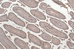 SH3GLB2 Mouse Monoclonal Antibody, Proteintech:Antibodies:Primary Antibodies
