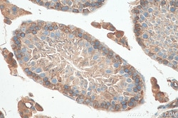 SH3GLB2 Mouse Monoclonal Antibody, Proteintech:Antibodies:Primary Antibodies