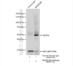 SH3GLB2 Mouse Monoclonal Antibody, Proteintech:Antibodies:Primary Antibodies