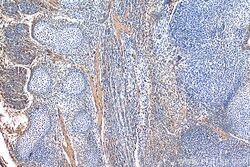 SHH Rabbit Polyclonal Antibody, Proteintech Unconjugated; 150 &mu;L:Antibodies,