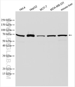 SHH Rabbit Polyclonal Antibody, Proteintech Unconjugated; 150 &mu;L:Antibodies,