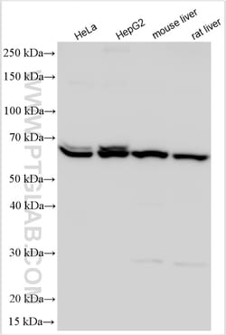 SHH Rabbit Polyclonal Antibody, Proteintech Unconjugated; 150 &mu;L:Antibodies,