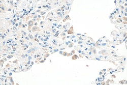 SHISA8 Rabbit Polyclonal Antibody, Proteintech Unconjugated; 20 &mu;L:Antibodies,