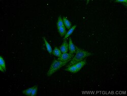 SHMT1 Mouse Monoclonal Antibody, Proteintech:Antibodies:Primary Antibodies