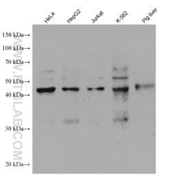 SHMT1 Mouse Monoclonal Antibody, Proteintech:Antibodies:Primary Antibodies
