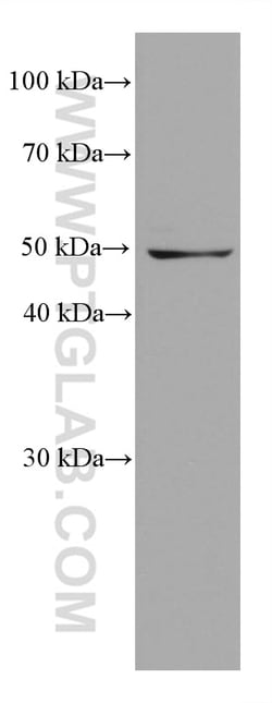 SHMT2 Mouse Monoclonal Antibody, Proteintech:Antibodies:Primary Antibodies
