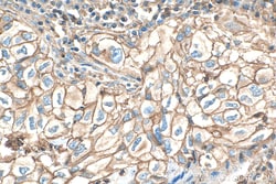 SIRP Beta 1 Mouse Monoclonal Antibody, Proteintech Unconjugated; 150 &mu;L:Antibodies,
