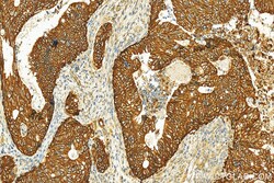 NKCC1,SLC12A2 Rabbit Polyclonal Antibody, Proteintech:Antibodies:Primary