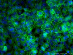 NKCC1,SLC12A2 Rabbit Polyclonal Antibody, Proteintech:Antibodies:Primary