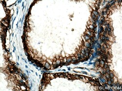 NKCC1,SLC12A2 Rabbit Polyclonal Antibody, Proteintech:Antibodies:Primary