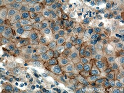 NKCC1,SLC12A2 Rabbit Polyclonal Antibody, Proteintech:Antibodies:Primary