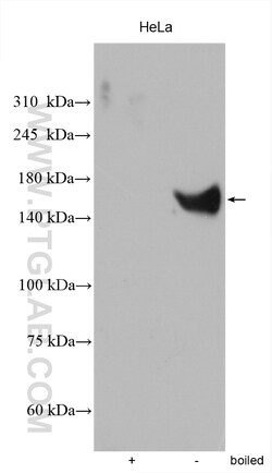 NKCC1,SLC12A2 Rabbit Polyclonal Antibody, Proteintech:Antibodies:Primary