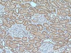 SLC16A5 Rabbit Polyclonal Antibody, Proteintech:Antibodies:Primary Antibodies