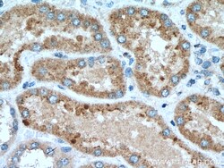 SLC16A5 Rabbit Polyclonal Antibody, Proteintech:Antibodies:Primary Antibodies