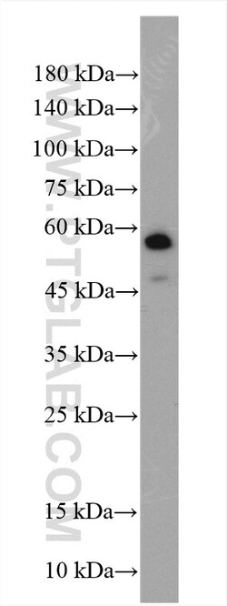 SLC16A5 Rabbit Polyclonal Antibody, Proteintech:Antibodies:Primary Antibodies