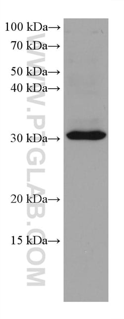 SLC25A42 Mouse Monoclonal Antibody, Proteintech Unconjugated; 150 &mu;L:Antibodies,