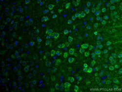 SLC25A47 Rabbit Polyclonal Antibody, Proteintech Unconjugated; 20 &mu;L:Antibodies,