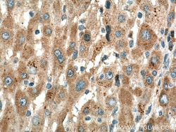 SLC25A47 Rabbit Polyclonal Antibody, Proteintech Unconjugated; 20 &mu;L:Antibodies,