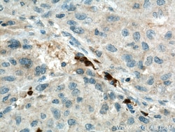 SLC25A47 Rabbit Polyclonal Antibody, Proteintech Unconjugated; 20 &mu;L:Antibodies,