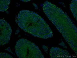 SLC26A8 Rabbit Polyclonal Antibody, Proteintech:Antibodies:Primary Antibodies