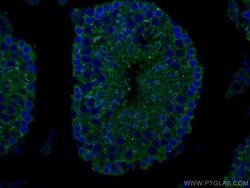 SLC26A8 Rabbit Polyclonal Antibody, Proteintech:Antibodies:Primary Antibodies