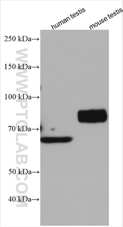 SLC26A8 Rabbit Polyclonal Antibody, Proteintech:Antibodies:Primary Antibodies