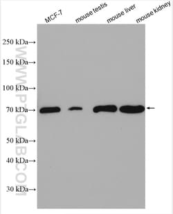 SLC27A6 Rabbit Polyclonal Antibody, Proteintech Unconjugated; 150 &mu;L:Antibodies,