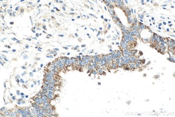 SLC30A2 Mouse Monoclonal Antibody, Proteintech Unconjugated; 150 &mu;L:Antibodies,