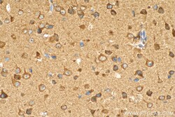 ZNT4 Rabbit Polyclonal Antibody, Proteintech:Antibodies:Primary Antibodies