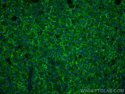SLC31A1 Rabbit Polyclonal Antibody, Proteintech:Antibodies:Primary Antibodies