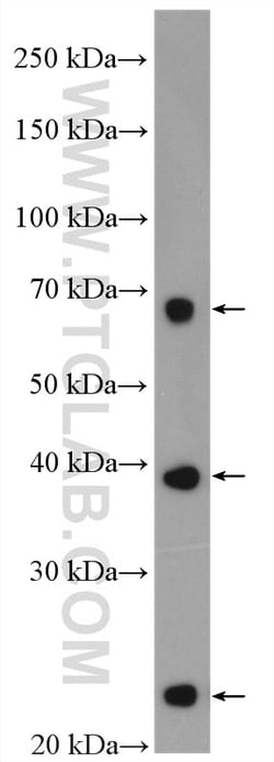 SLC31A1 Rabbit Polyclonal Antibody, Proteintech:Antibodies:Primary Antibodies