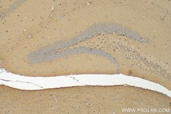 SLC38A1 Rabbit Polyclonal Antibody, Proteintech Unconjugated; 20 &mu;L:Antibodies,