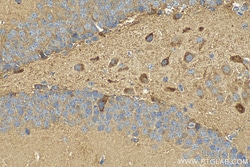SLC38A1 Rabbit Polyclonal Antibody, Proteintech Unconjugated; 20 &mu;L:Antibodies,
