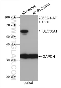 SLC38A1 Rabbit Polyclonal Antibody, Proteintech Unconjugated; 20 &mu;L:Antibodies,