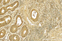 SLC39A5 Rabbit Polyclonal Antibody, Proteintech:Antibodies:Primary Antibodies