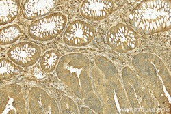 SLC39A5 Rabbit Polyclonal Antibody, Proteintech:Antibodies:Primary Antibodies