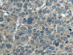SLC5A10 Rabbit Polyclonal Antibody, Proteintech Unconjugated; 20 &mu;L:Antibodies,