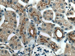SLC5A10 Rabbit Polyclonal Antibody, Proteintech Unconjugated; 20 &mu;L:Antibodies,