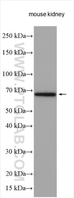 SLC5A10 Rabbit Polyclonal Antibody, Proteintech Unconjugated; 20 &mu;L:Antibodies,