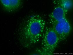 SLC6A12 Mouse Monoclonal Antibody, Proteintech:Antibodies:Primary Antibodies