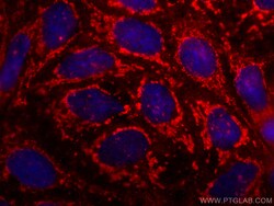 SLC6A12 Mouse Monoclonal Antibody, Proteintech:Antibodies:Primary Antibodies