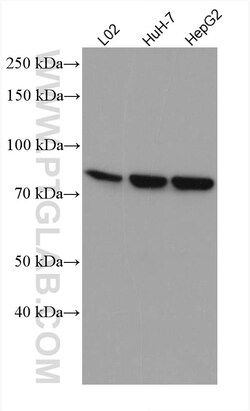 SLC6A12 Mouse Monoclonal Antibody, Proteintech:Antibodies:Primary Antibodies