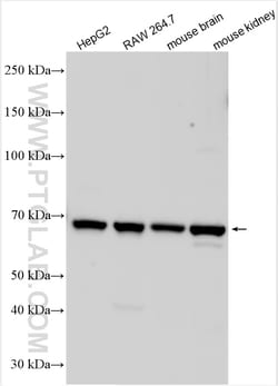 SLC6A18 Rabbit Polyclonal Antibody, Proteintech Unconjugated; 20 &mu;L:Antibodies,